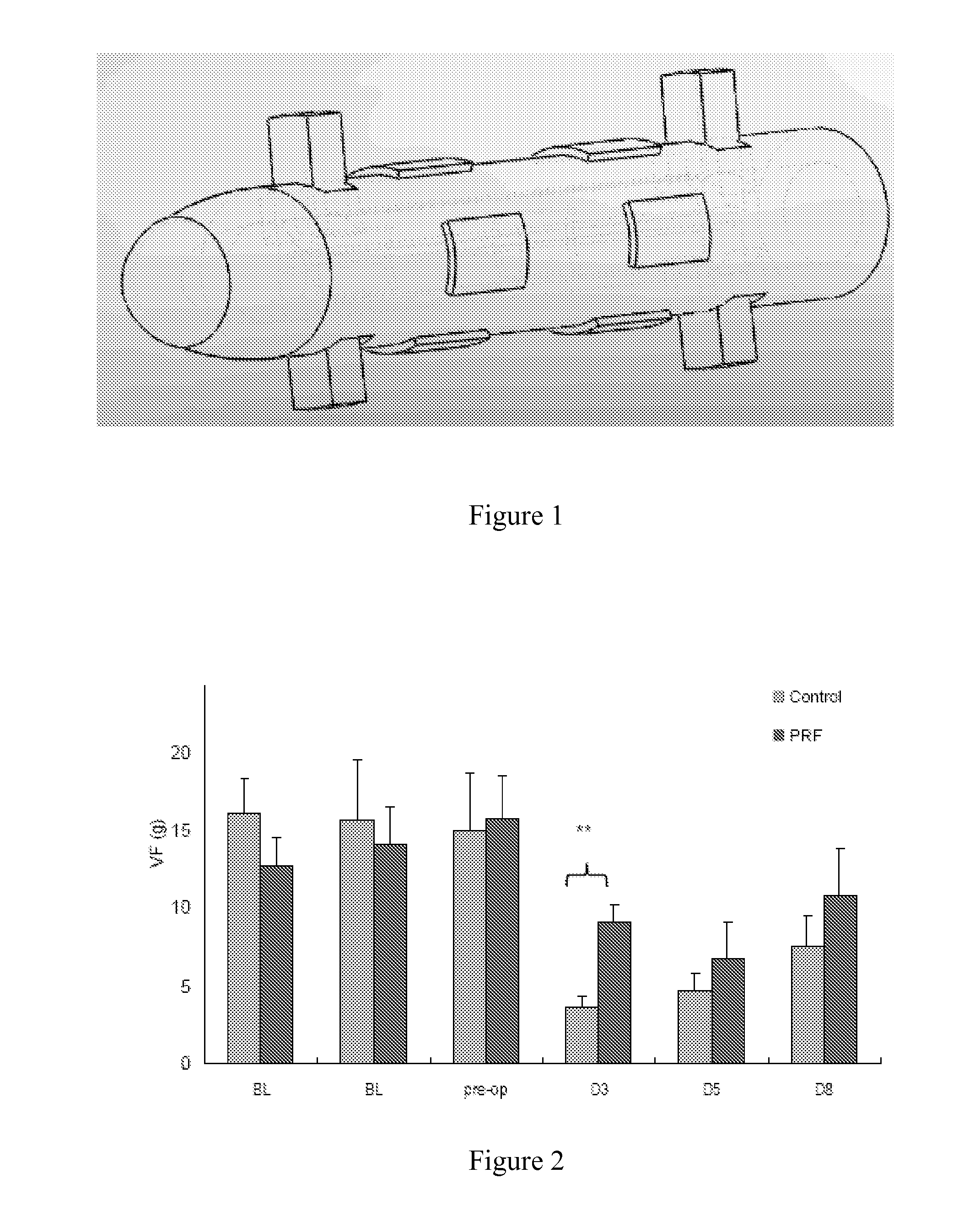 Implantable pulsed-radiofrequency micro-stimulation system