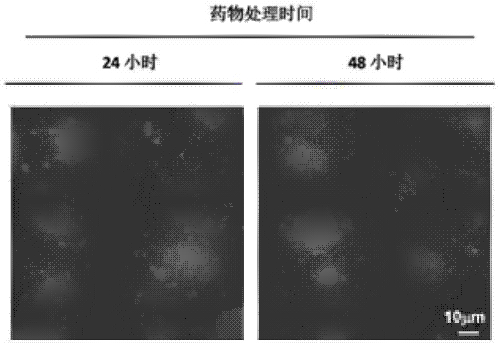 PLK1 inhibitor, and preparation method and application thereof