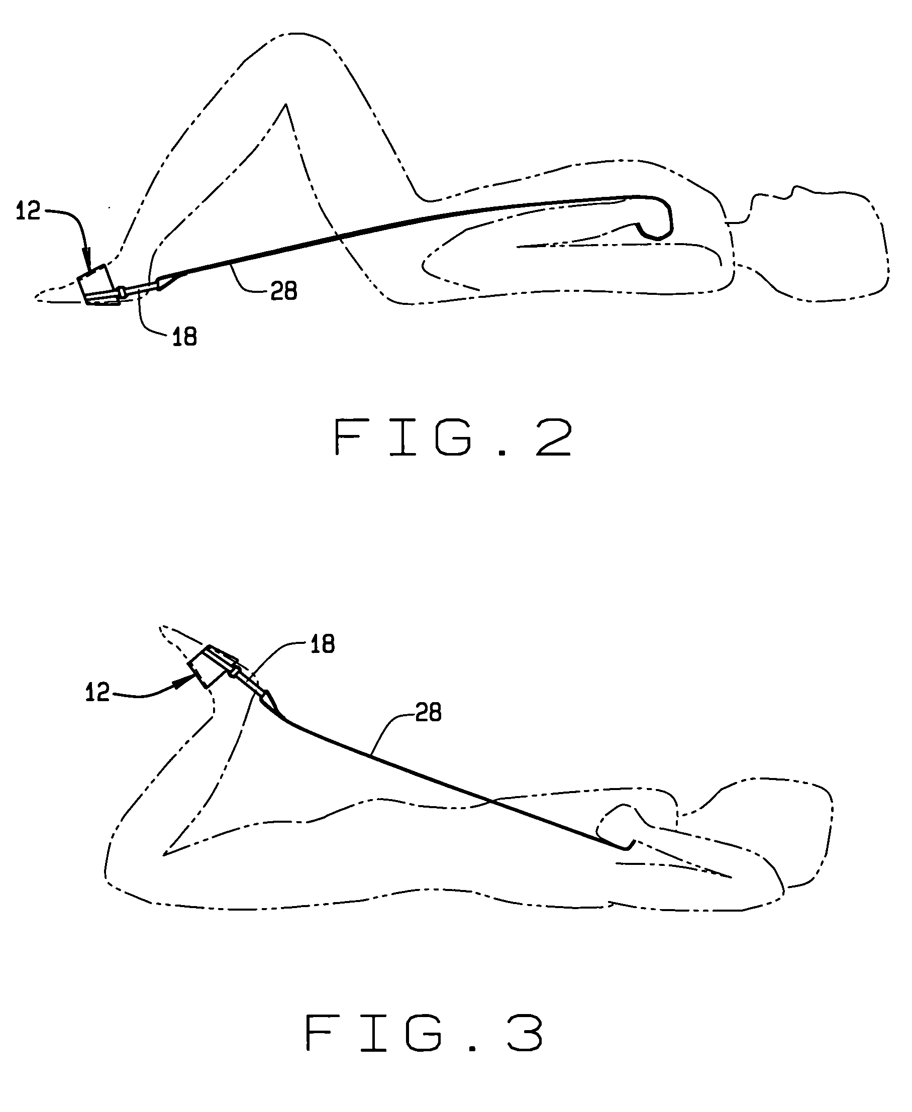 Therapeutic knee exercise apparatus