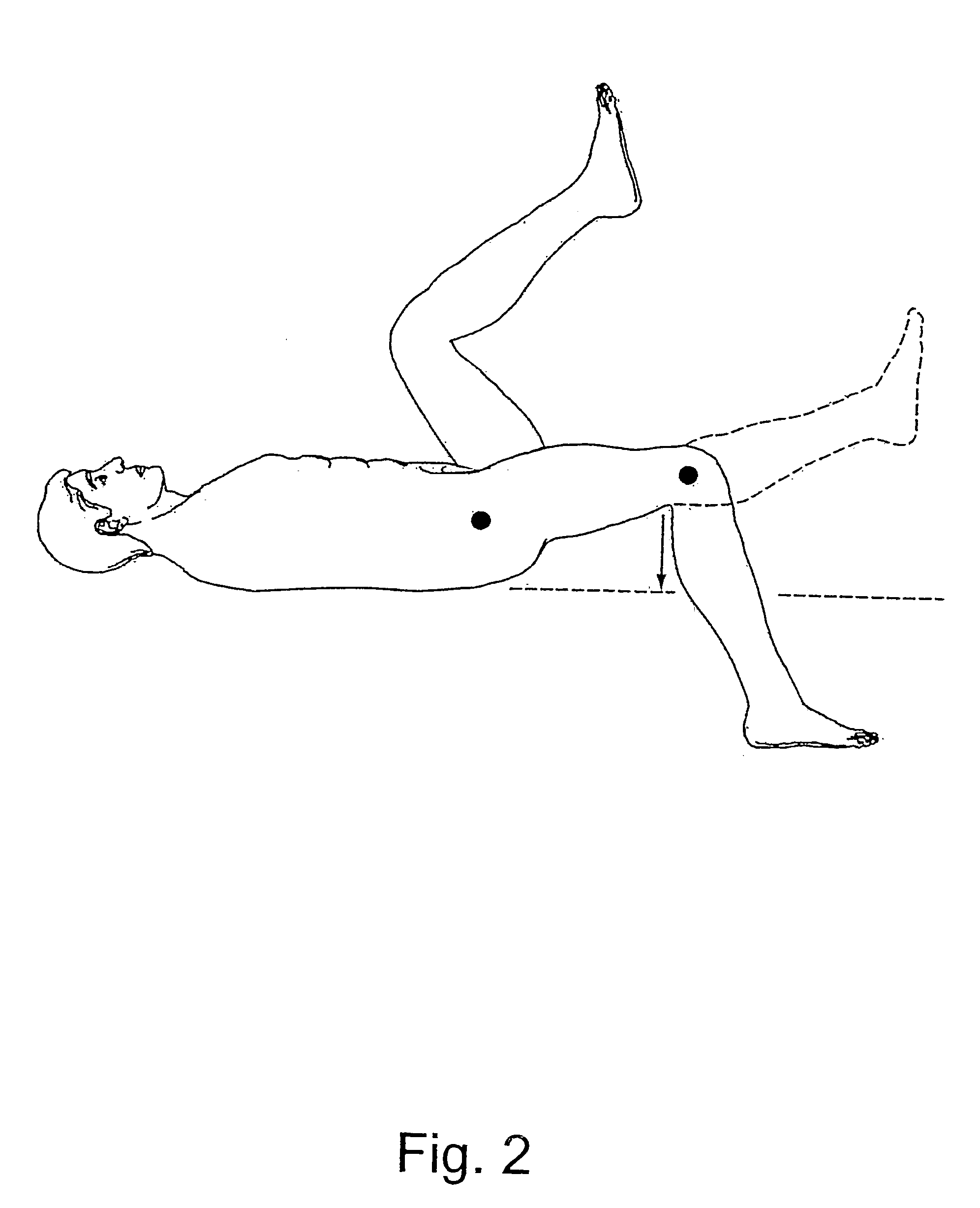 Stretching apparatus