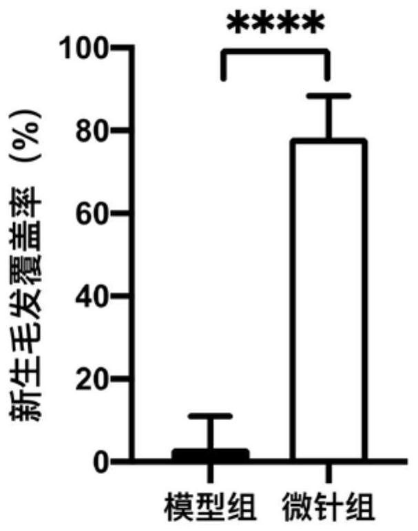 Hair growth microneedle patch containing androgen receptor protein targeted complex as well as preparation method and application of hair growth microneedle patch