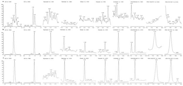 A method for simultaneous detection of four types of ethanol non-oxidative metabolites in human whole blood