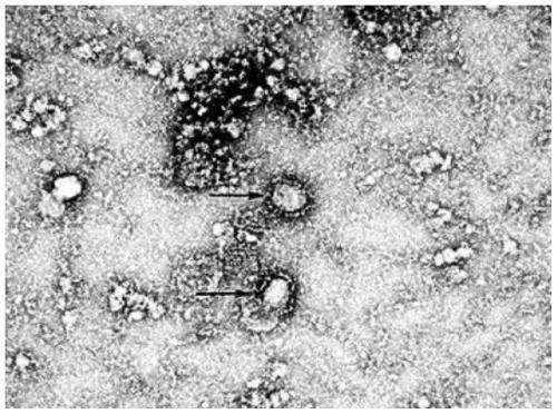 Novel coronavirus detection kit