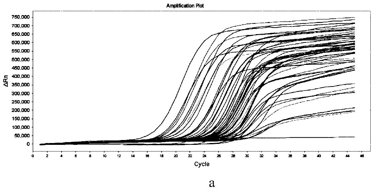 Novel coronavirus detection kit