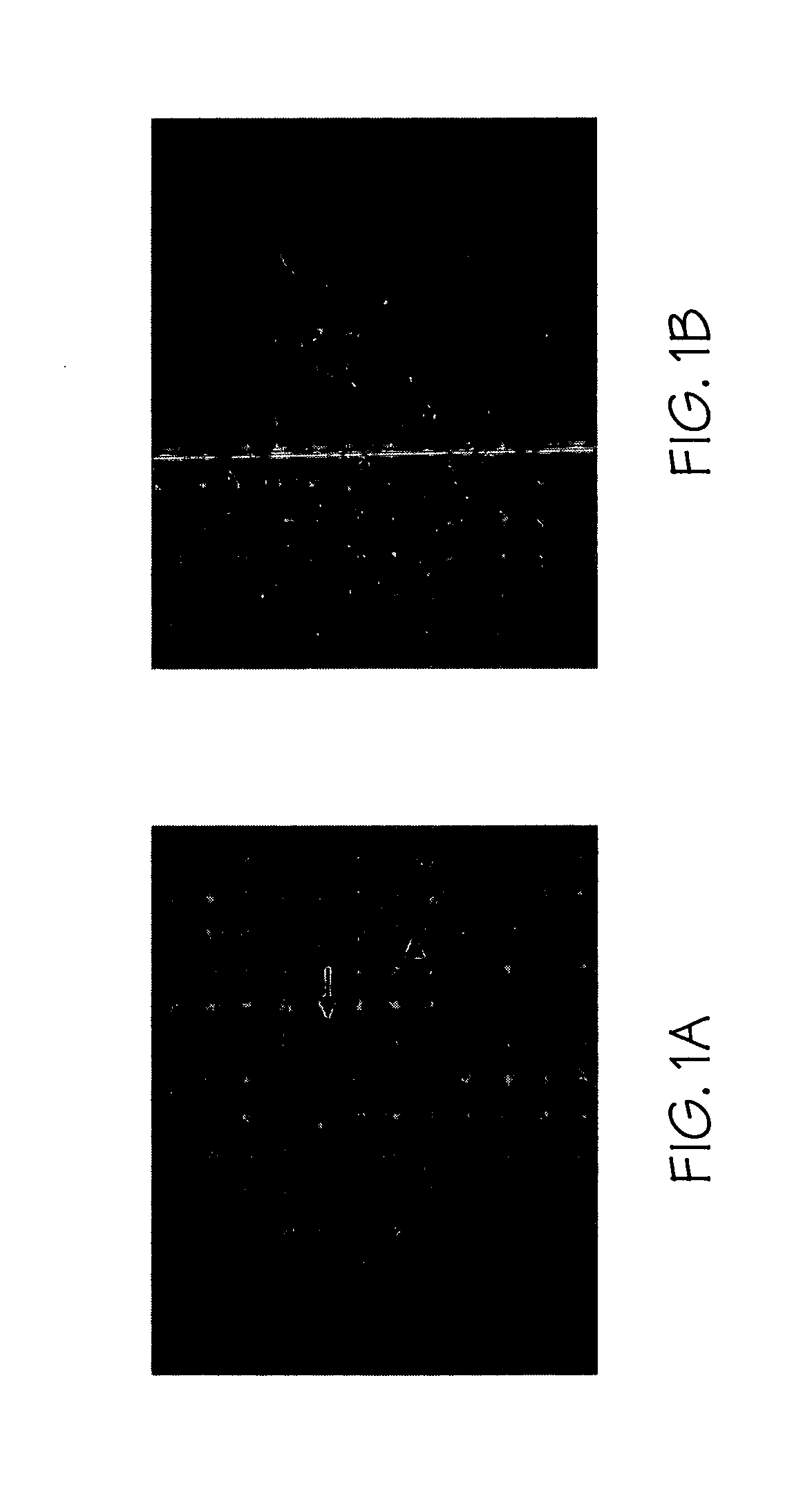 Method for diagnosis and treatment of pulmonary disorders