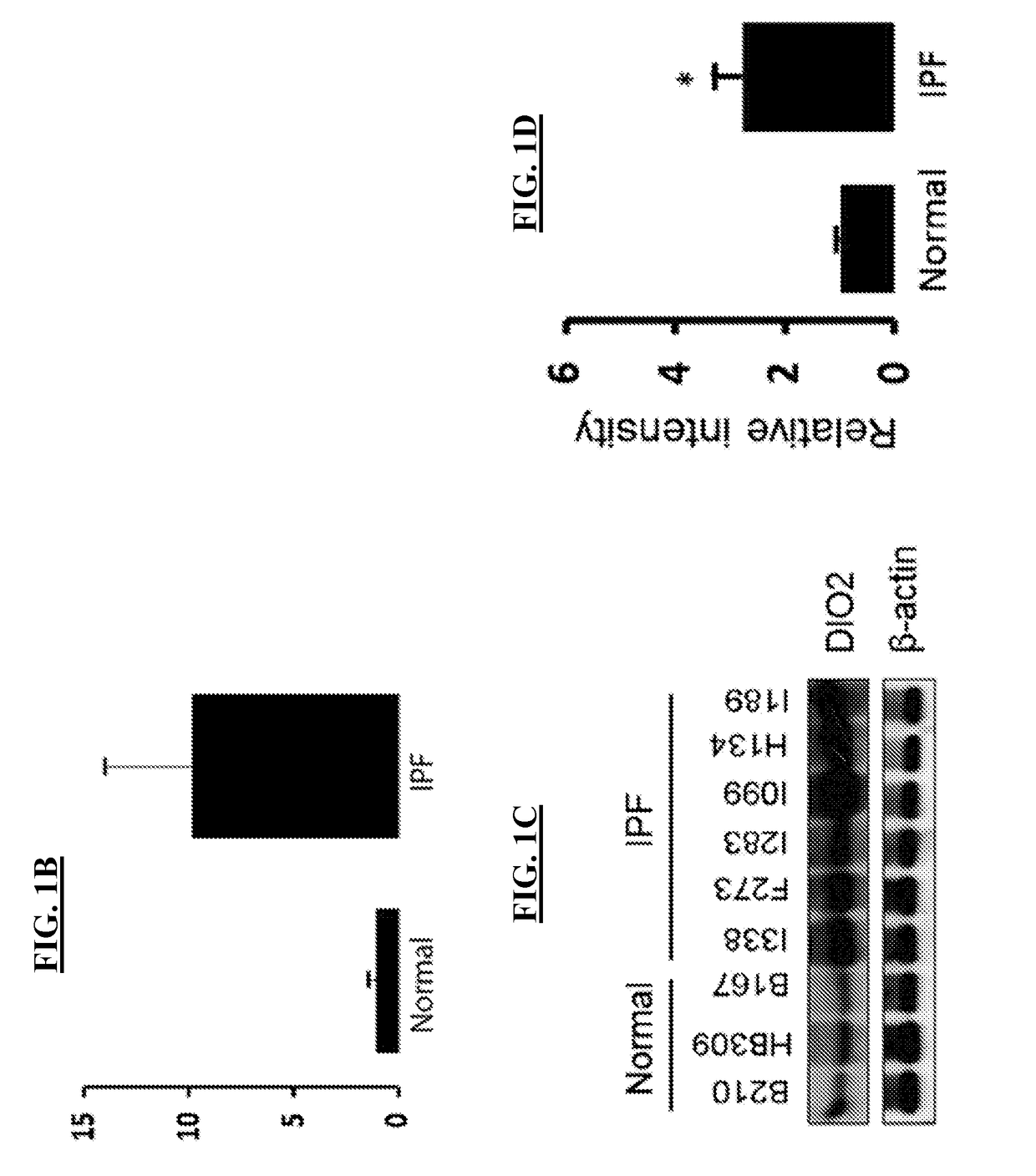 Novel methods of treating or preventing fibrotic lung diseases