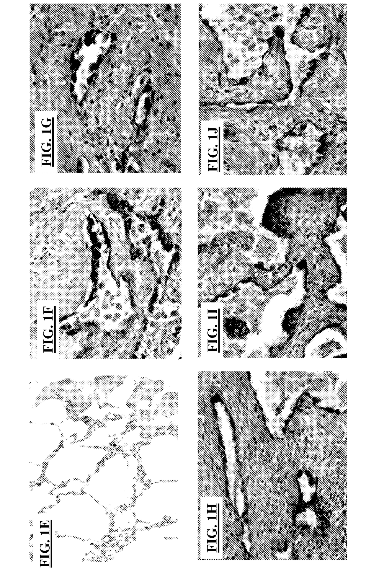 Novel methods of treating or preventing fibrotic lung diseases