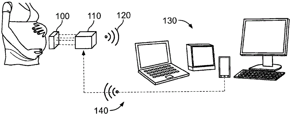 Wireless pregnancy monitor