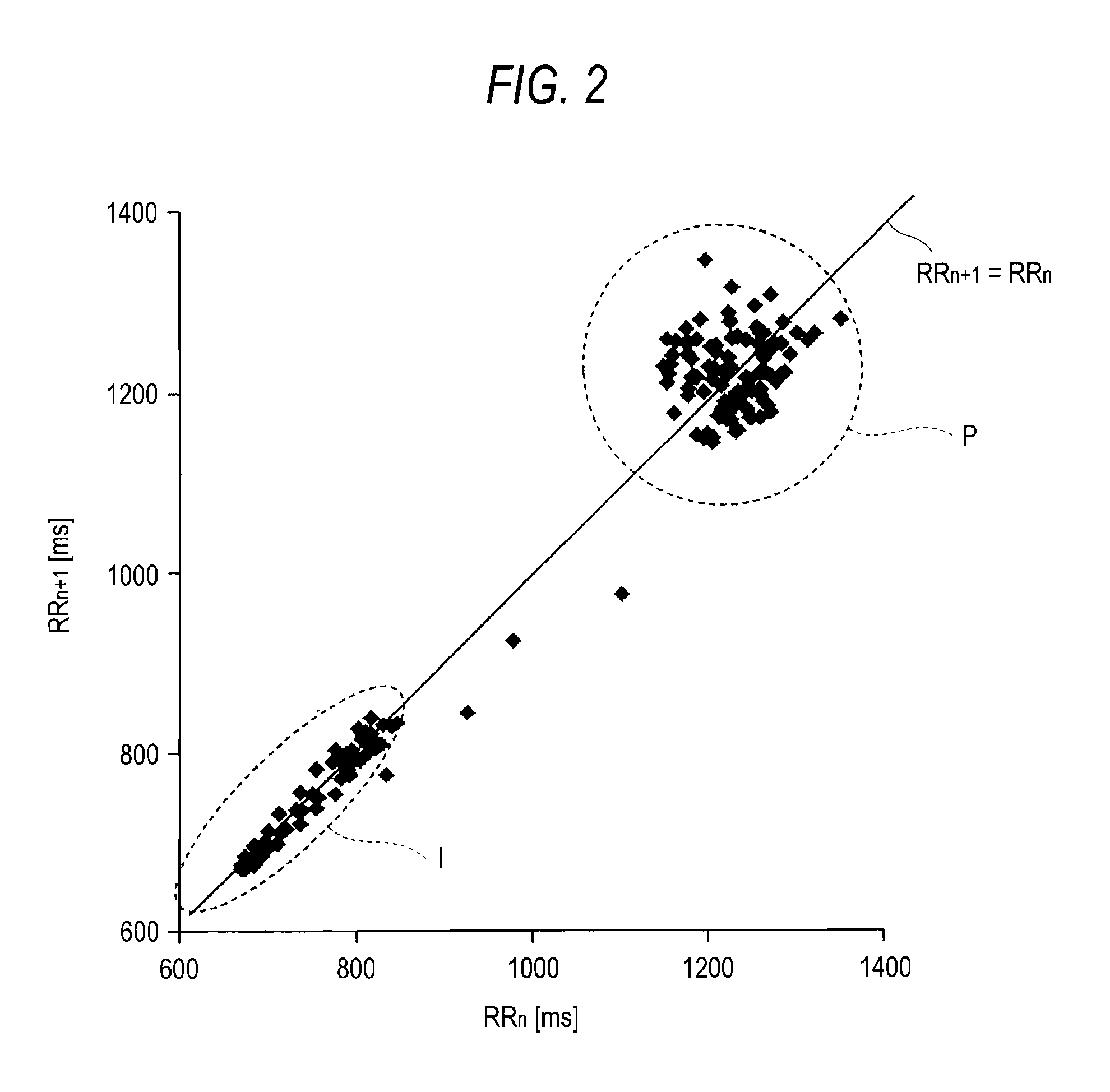 Apparatus and method for detecting epilepsy seizure