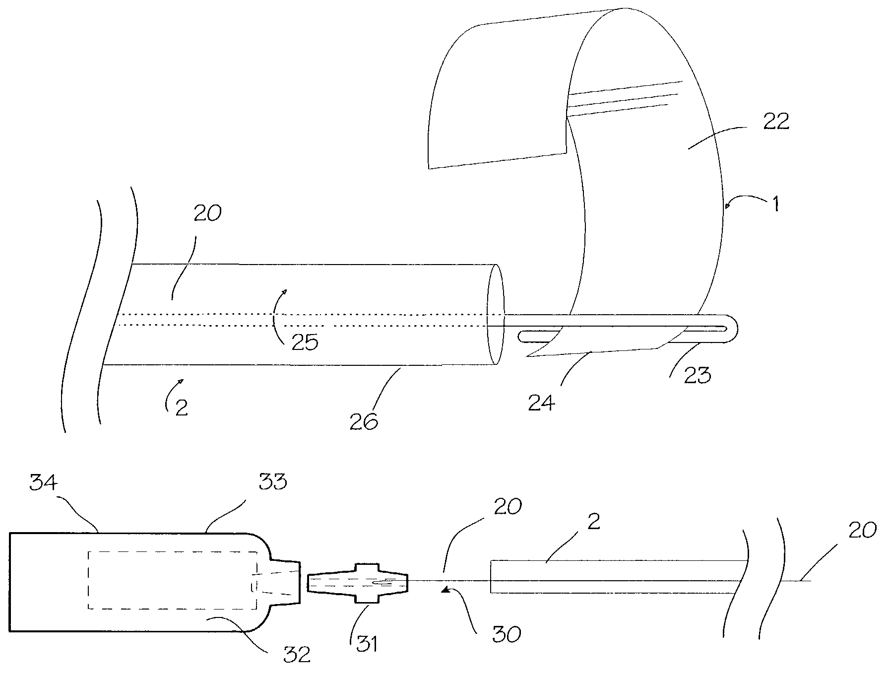 Expandable stent apparatus and method