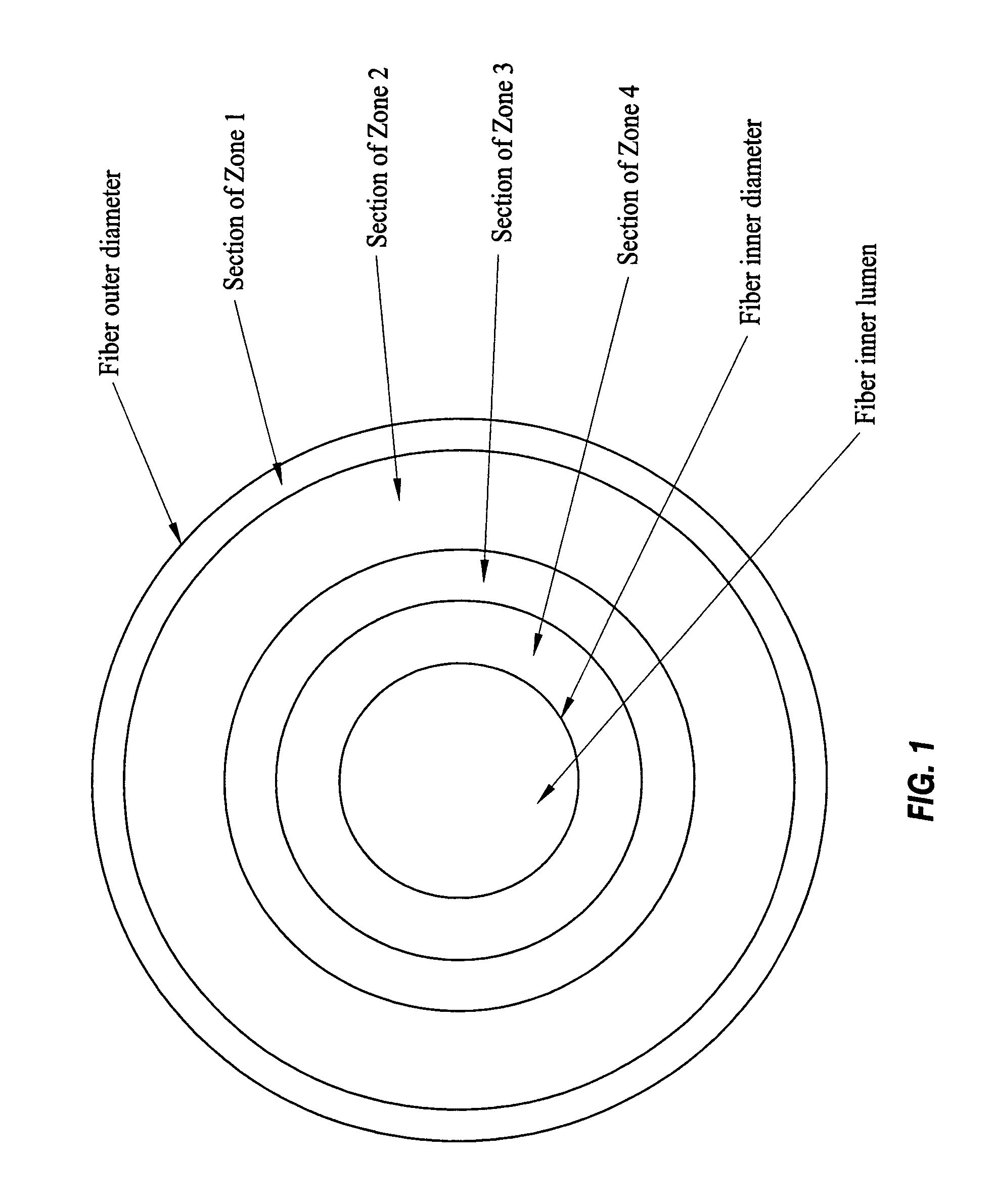 Specialized hollow fiber membranes for plasmapheresis and ultrafiltration