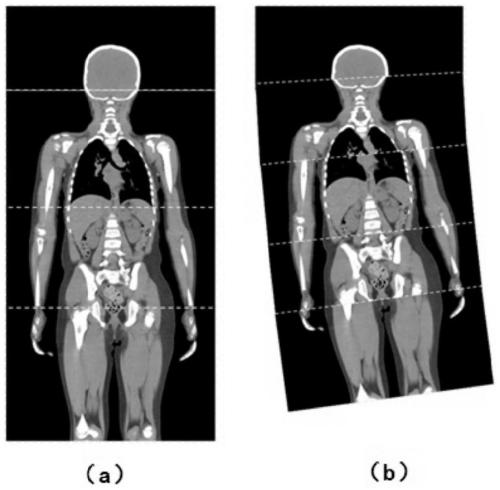 Stepped imaging method for mobile CT system