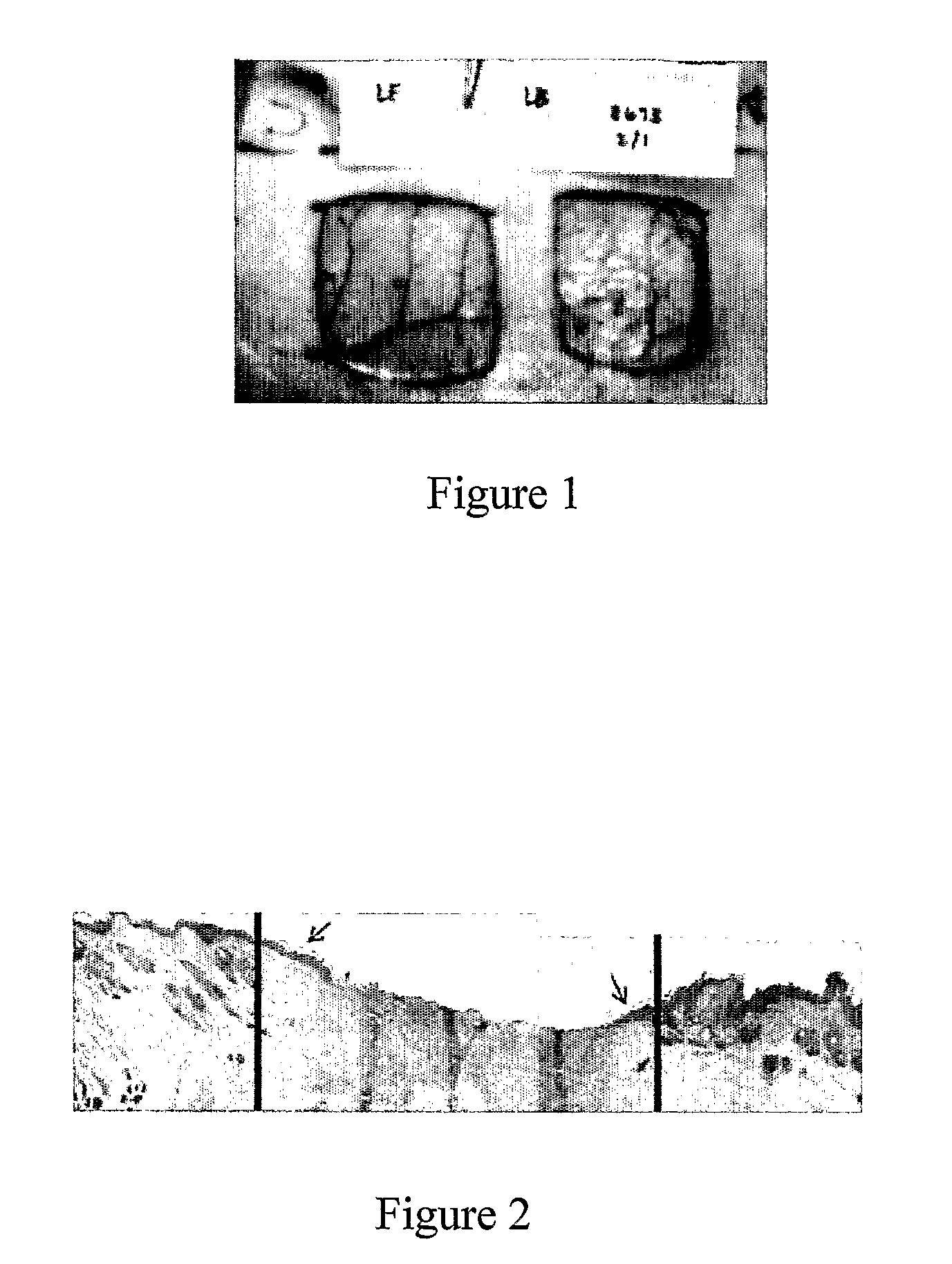 Endothelial predecessor cell seeded wound healing scaffold