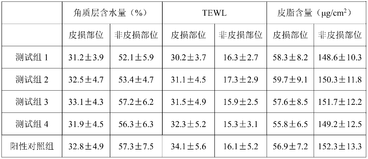 Traditional Chinese medicine composition for treating psoriasis and preparation method and application of traditional Chinese medicine composition