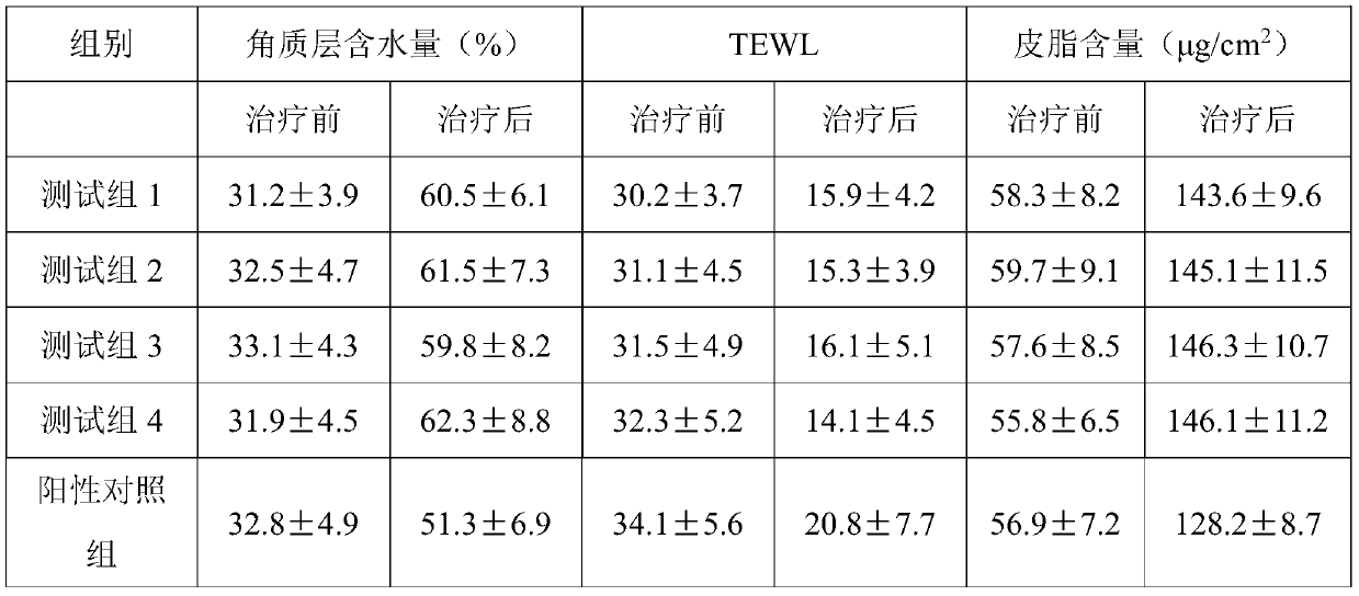 Traditional Chinese medicine composition for treating psoriasis and preparation method and application of traditional Chinese medicine composition