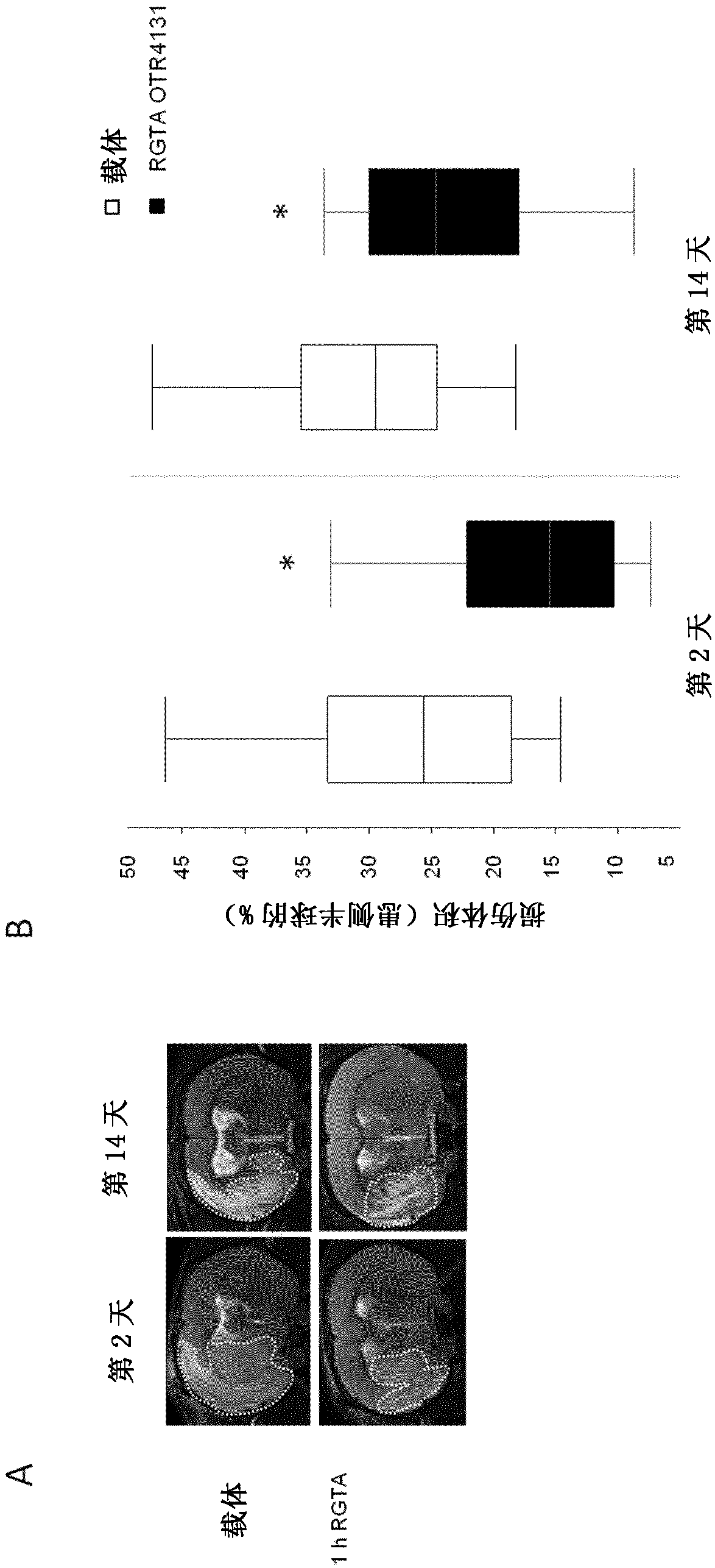 Composition for treating brain lesions