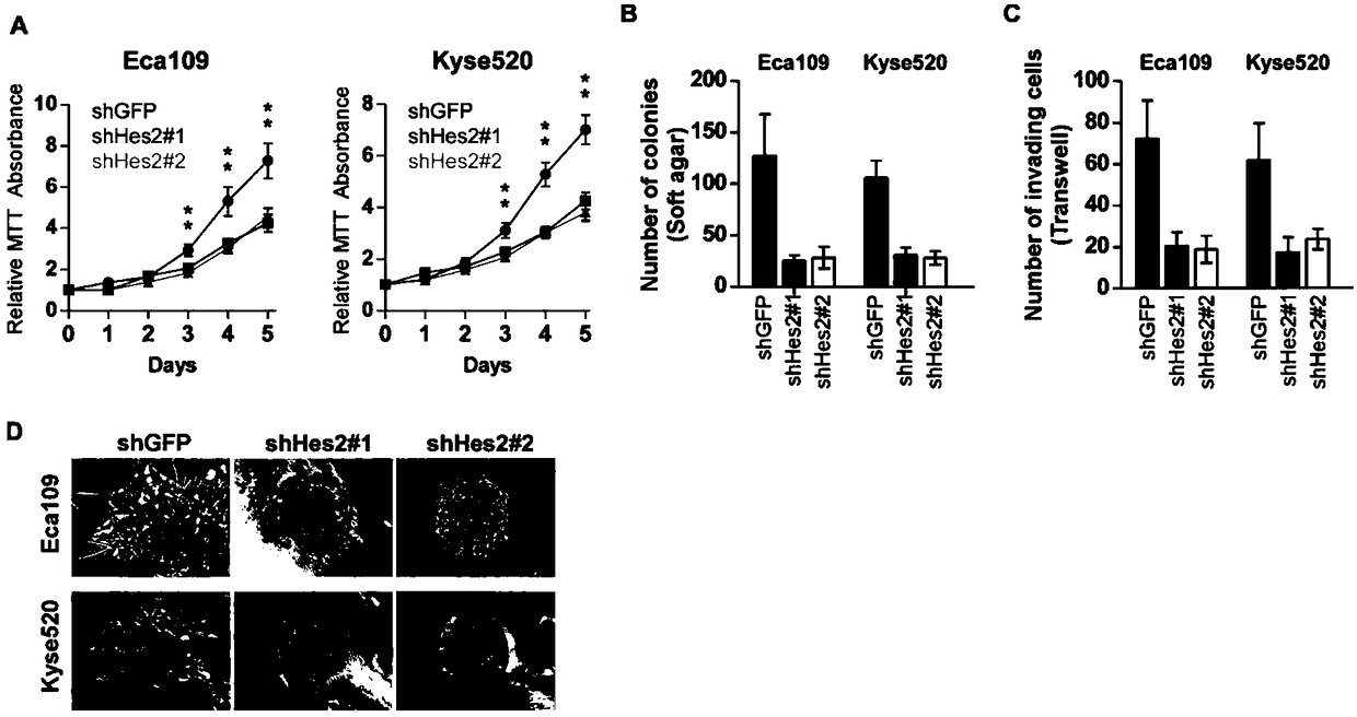 Application of gene HES2 to auxiliary diagnosis, prognosis and treatment of esophageal squamous carcinoma