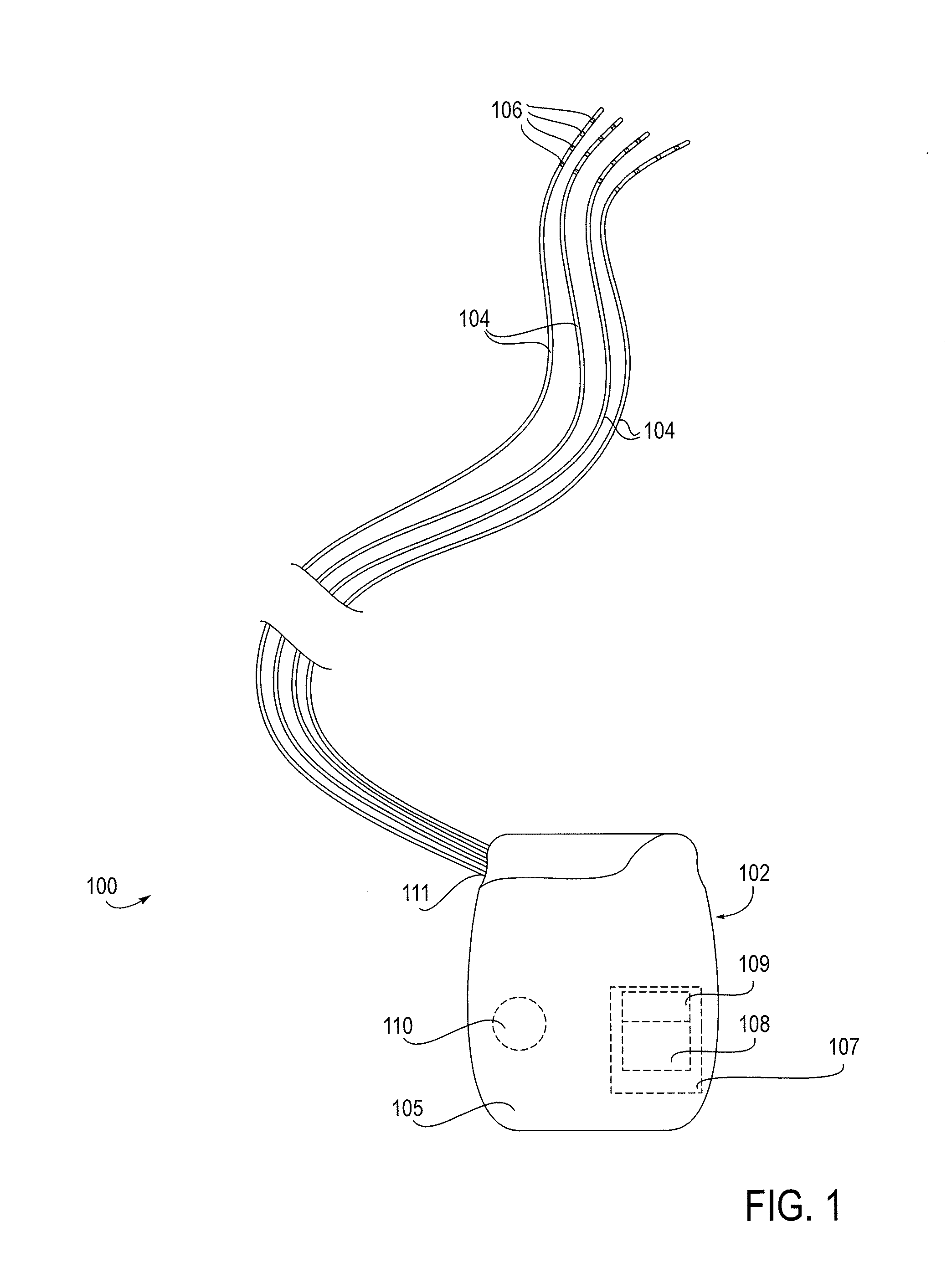 Selective stimulation to modulate the sympathetic nervous system