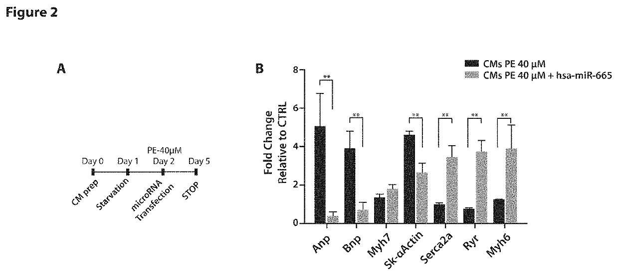 Microrna hsa-mir-665 in cardiac hypertrophy