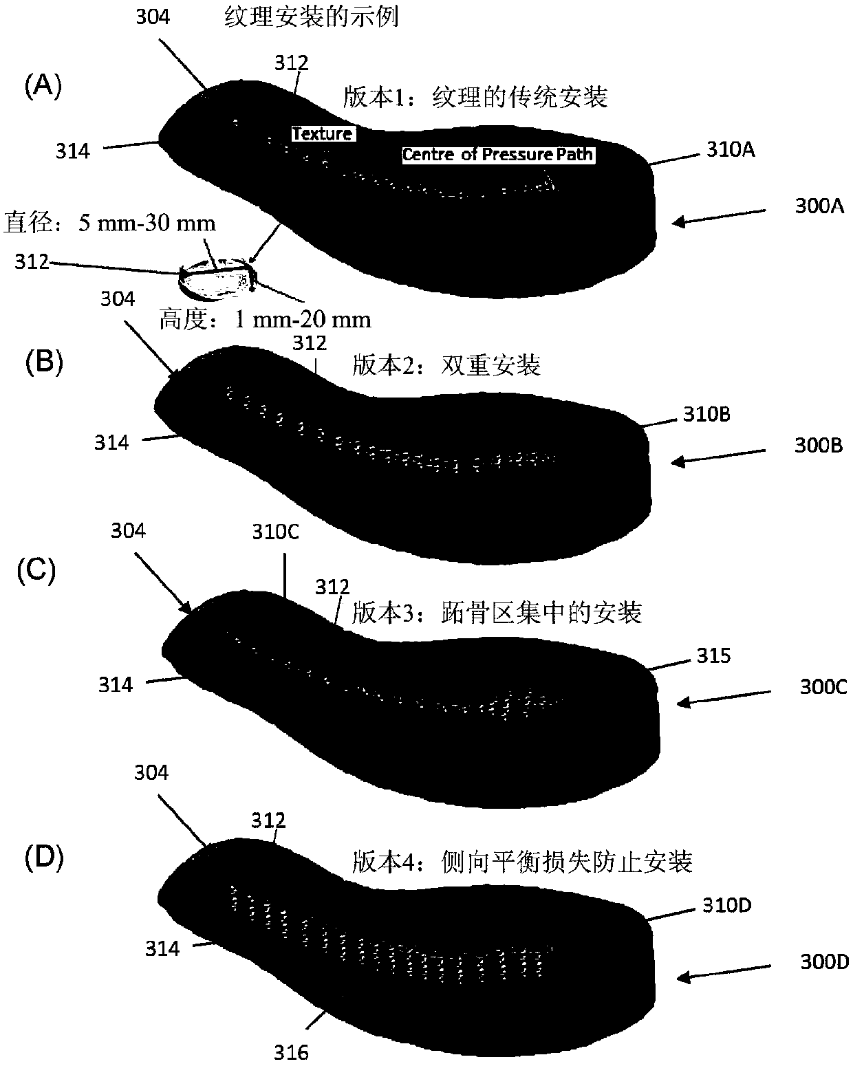 Injury reduction insole