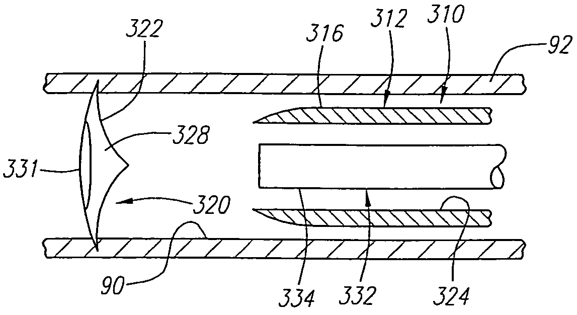 Apparatus and methods for reducing lung volume