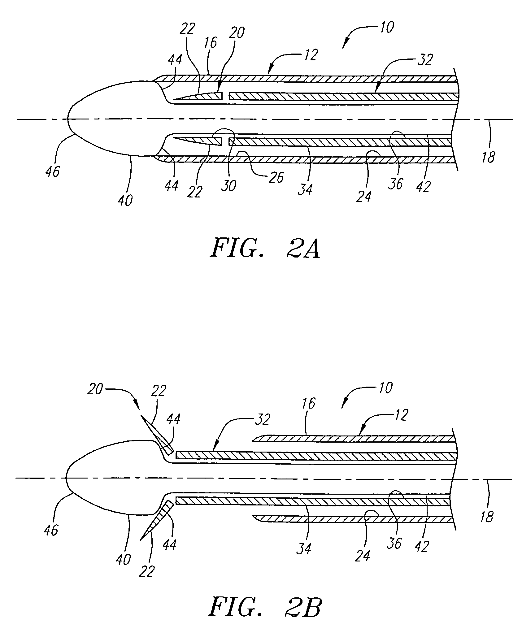 Apparatus and methods for reducing lung volume