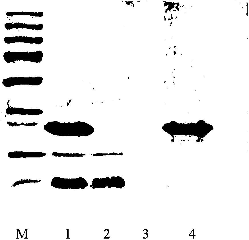 Therapeutic Peptides for Excitotoxicity-Related Injuries