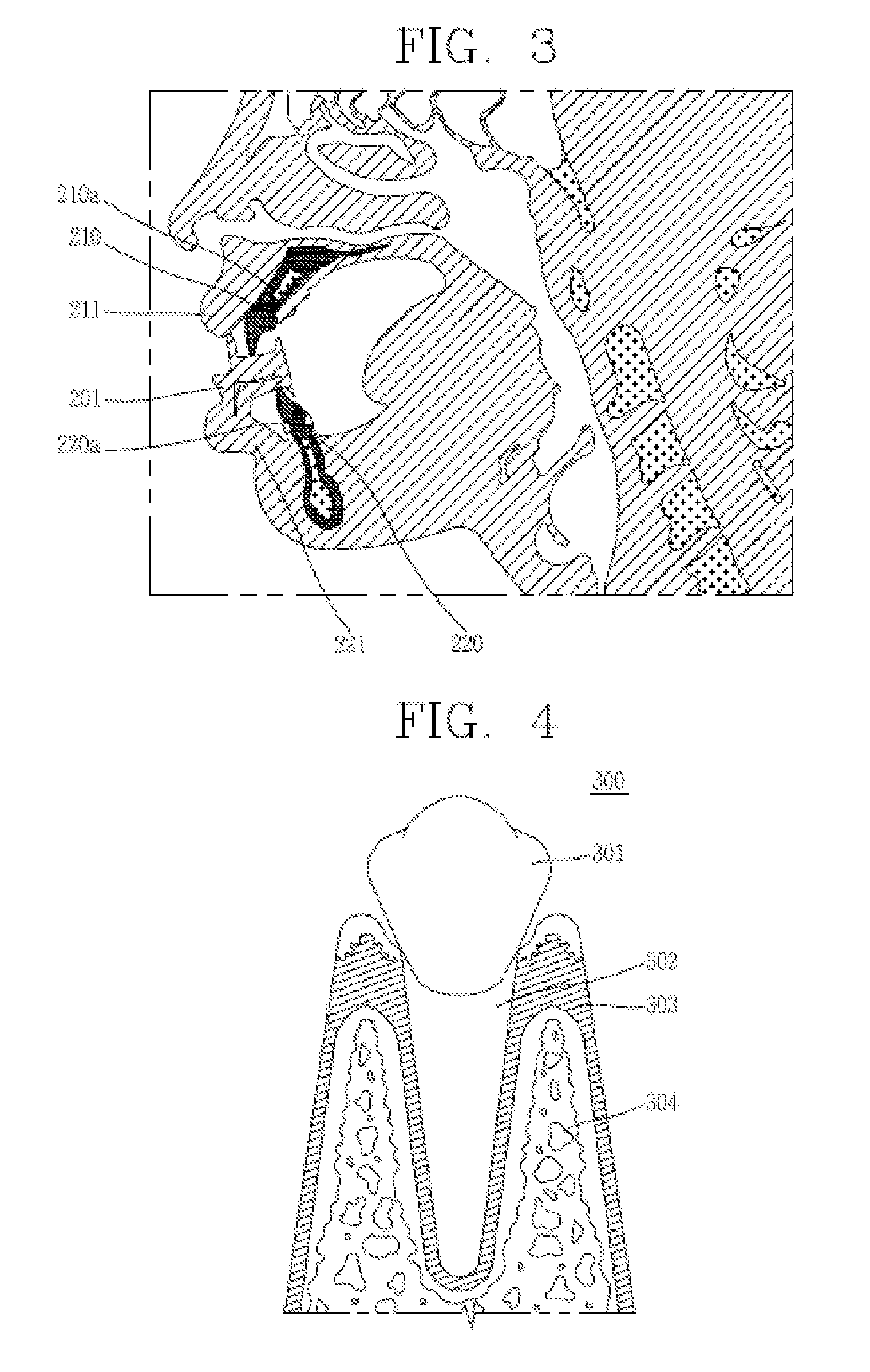 Apparatus for generating dental data for manufacturing an aligner and method of manufacturing clear aligner using the apparatus