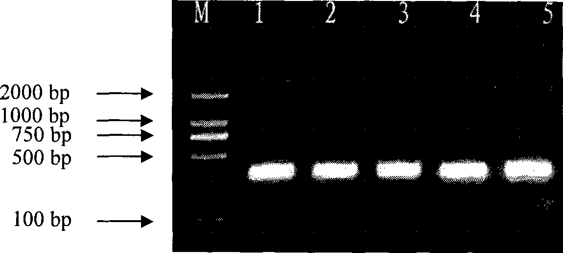 Nucleotide specific to ITS of Balcillus proteus mirabilis and use thereof