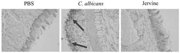 Application of Garlic Veratrine in the Preparation of Drugs for Prevention and Treatment of Candida Albicans Infection