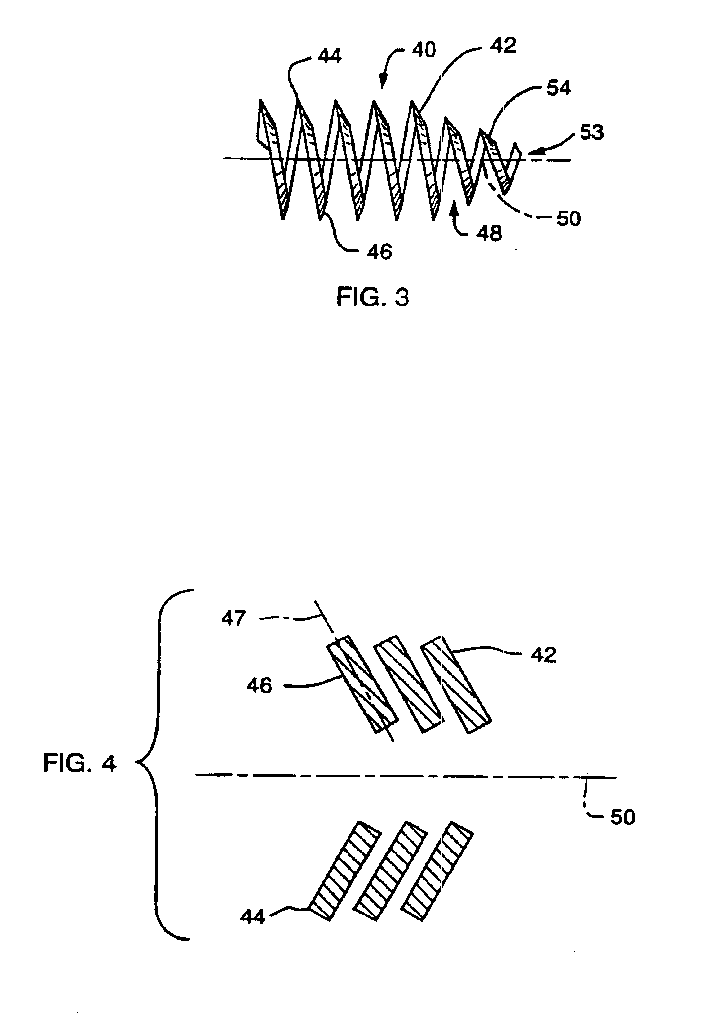 Implant and agent delivery device