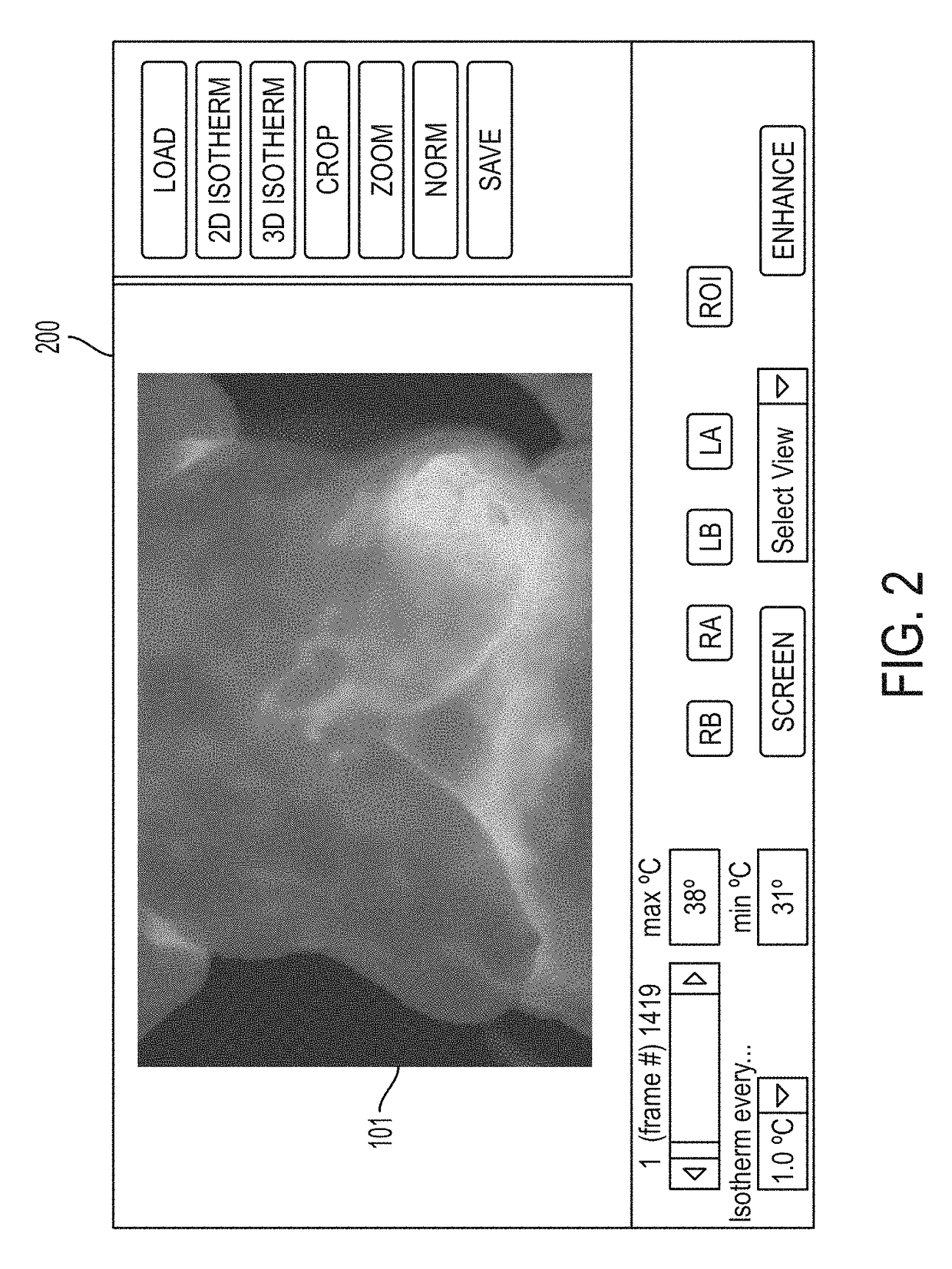 Privacy booth for breast cancer screening