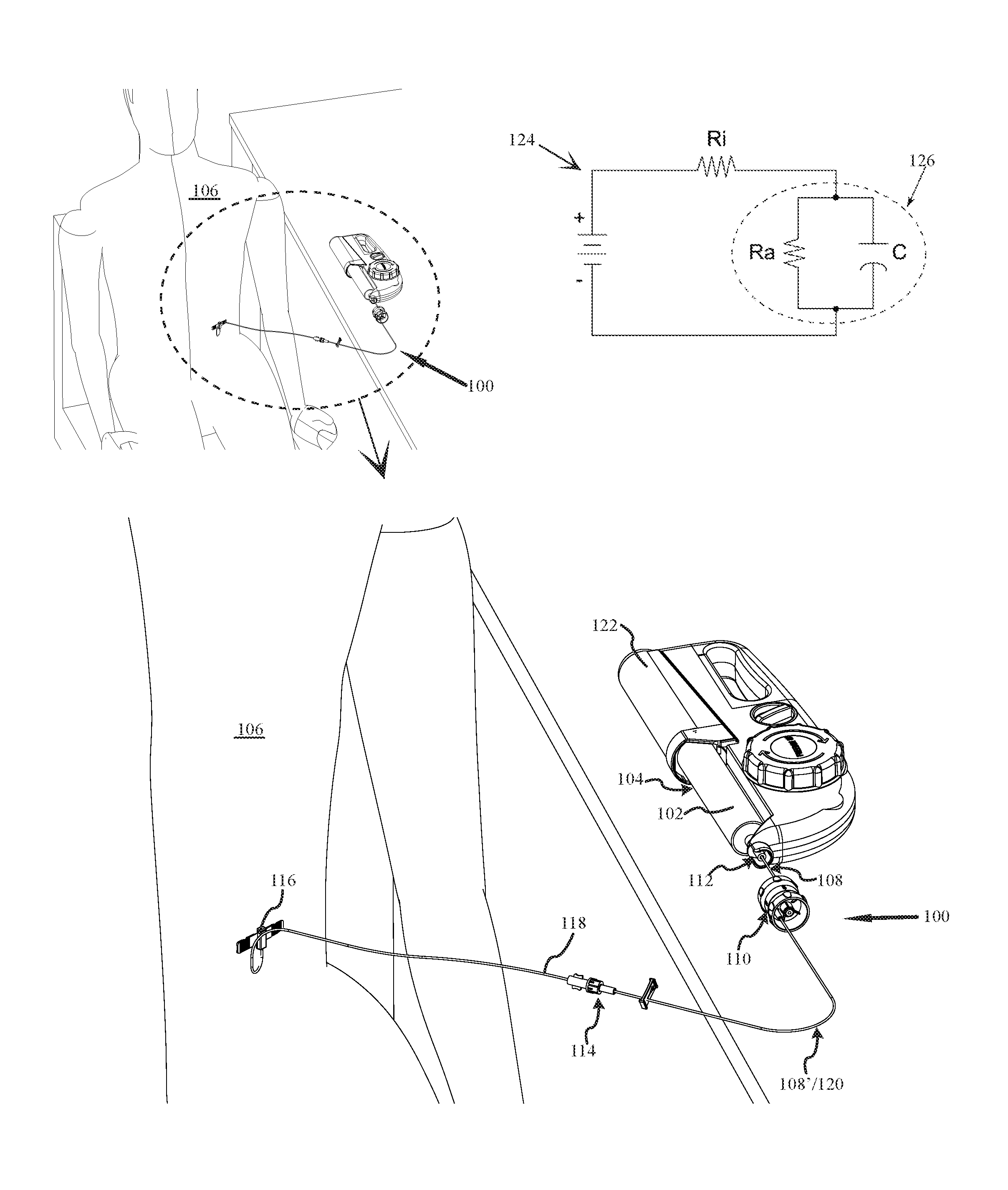 Precision variable flow rate infusion system and method