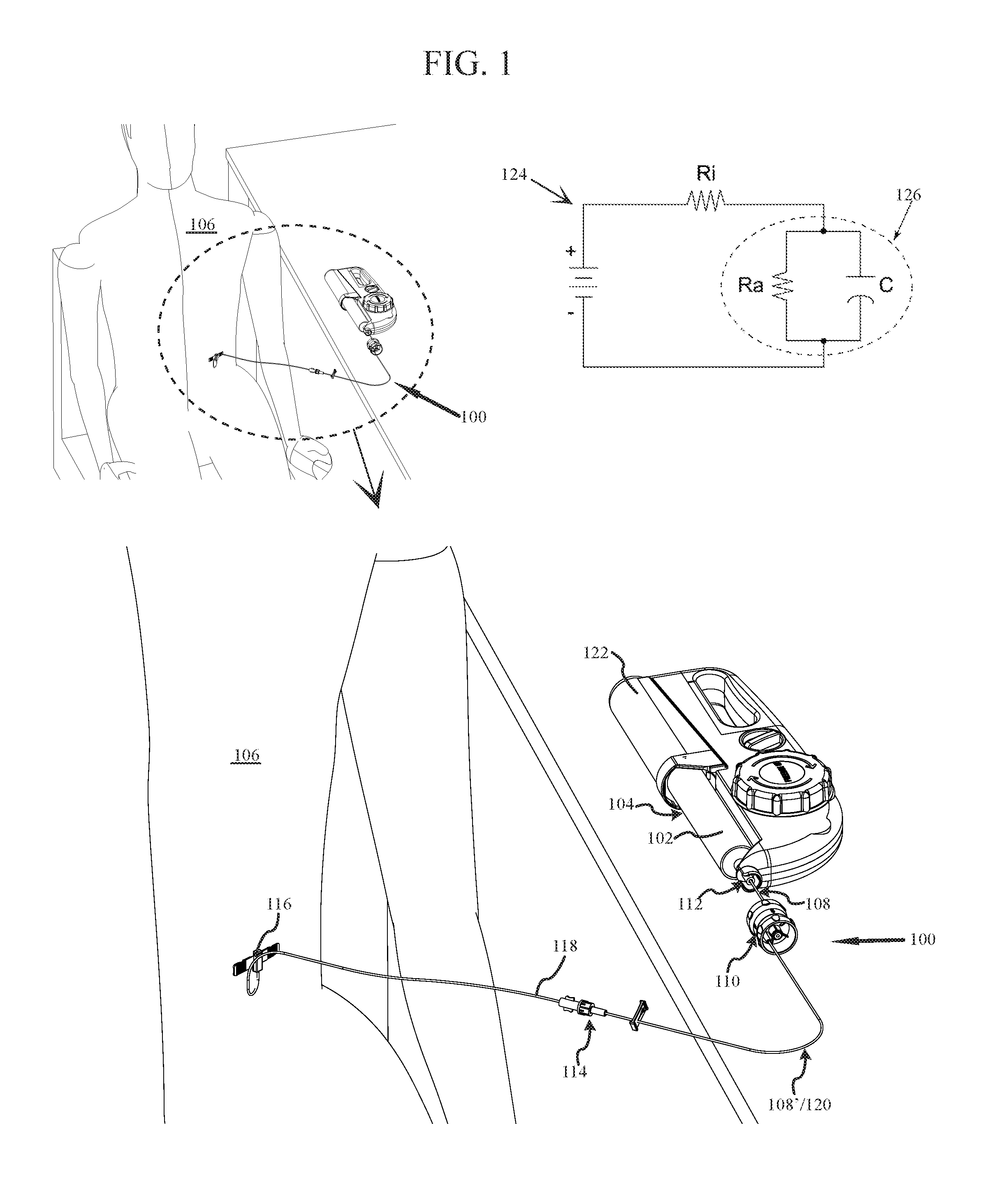 Precision variable flow rate infusion system and method