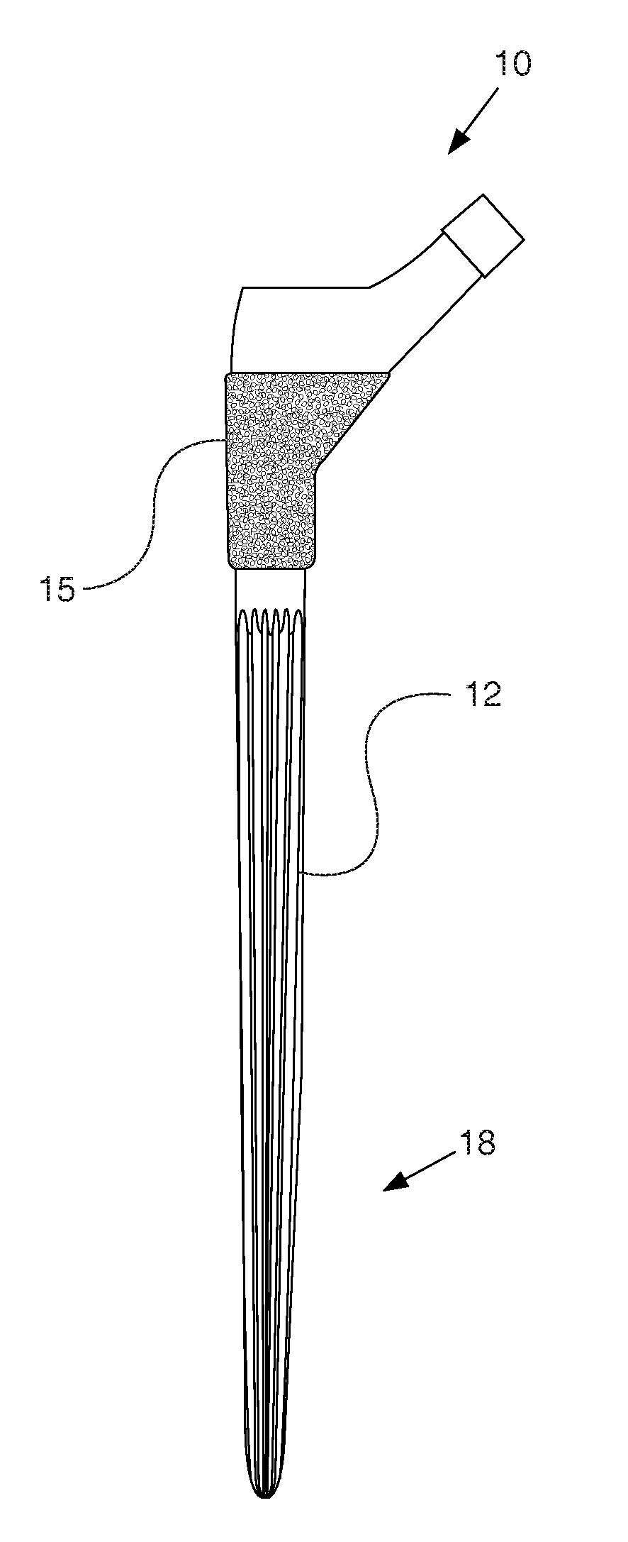 Fluted sleeve hip prosthesis for modular stem