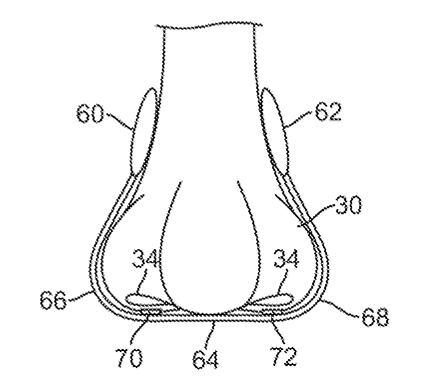 Airflow restriction system