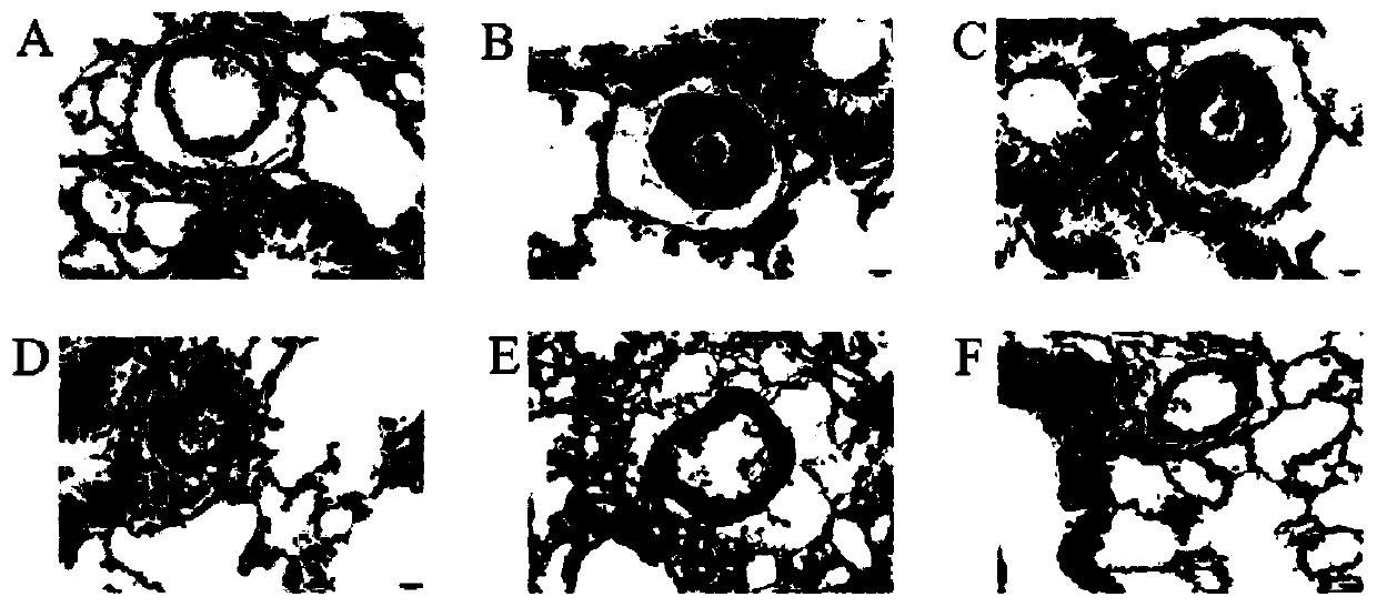 Use of isorhamnetin in preparation of drugs for treatment of pulmonary hypertension