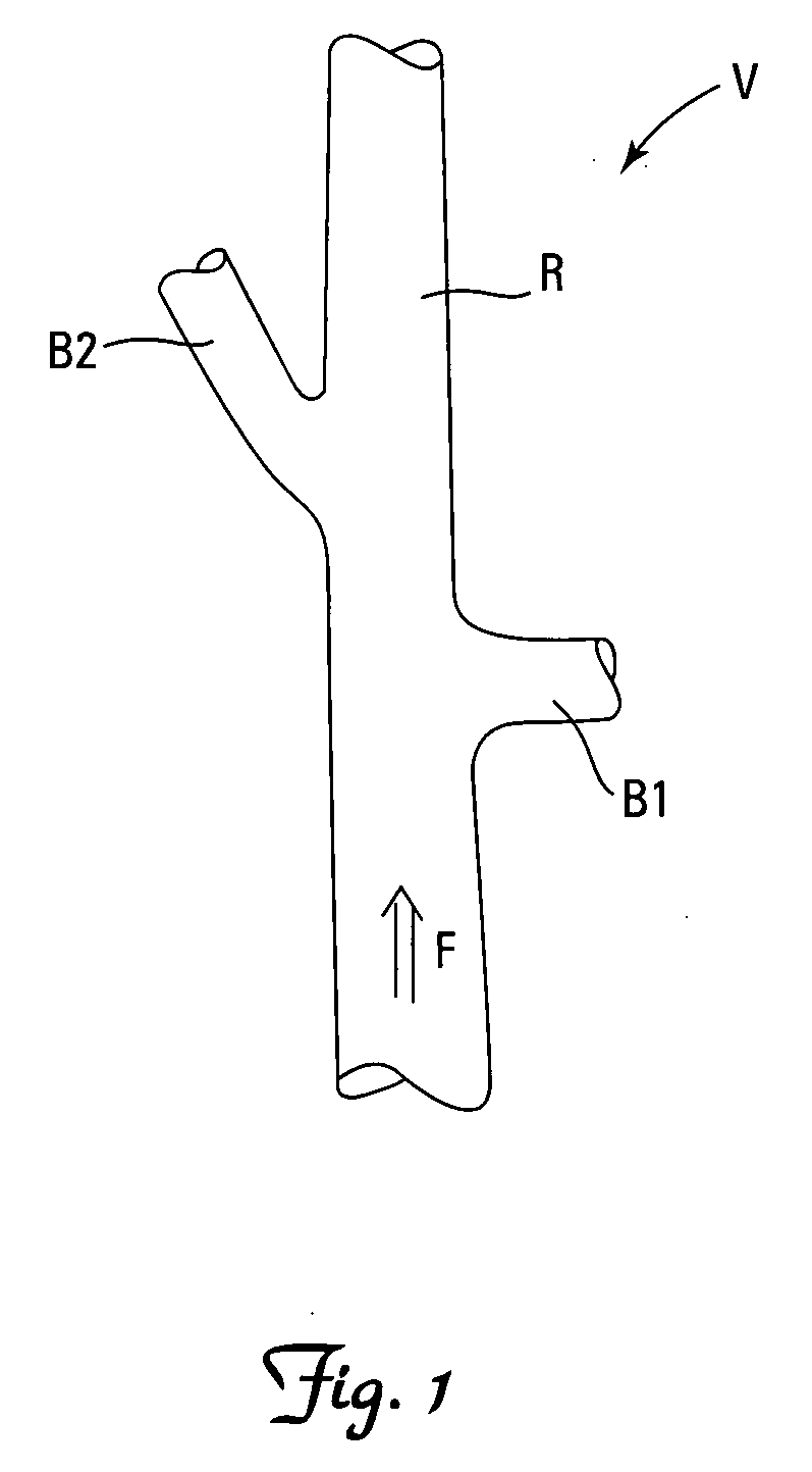 Embolic protection systems