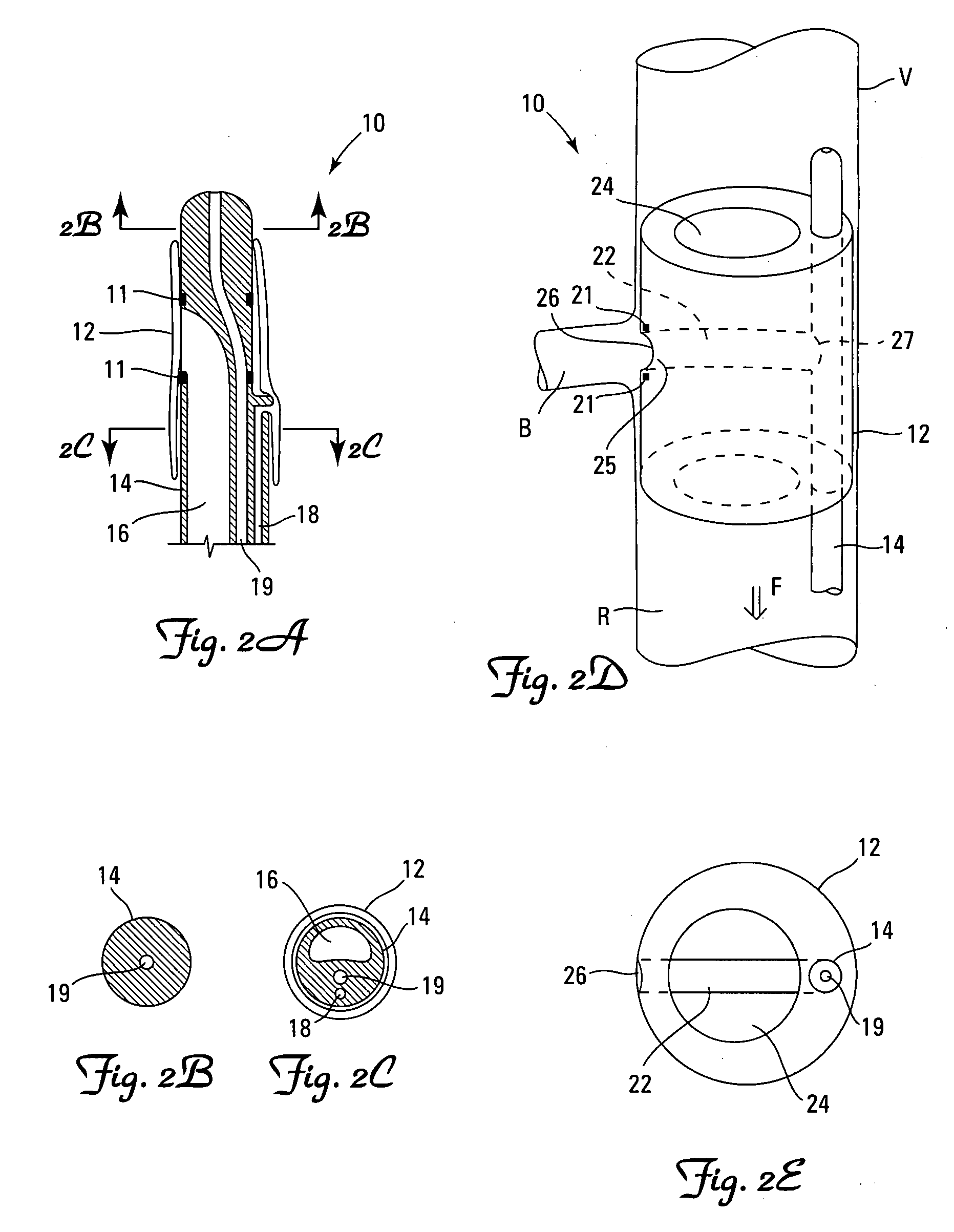 Embolic protection systems