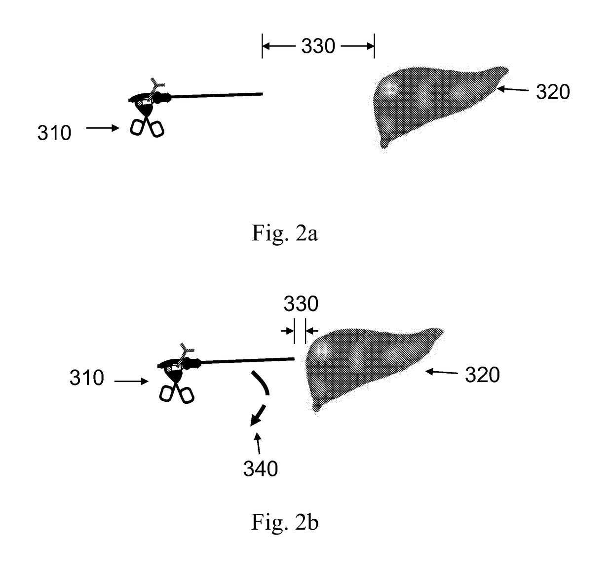 Device and method for assisting laparoscopic surgery utilizing a touch screen