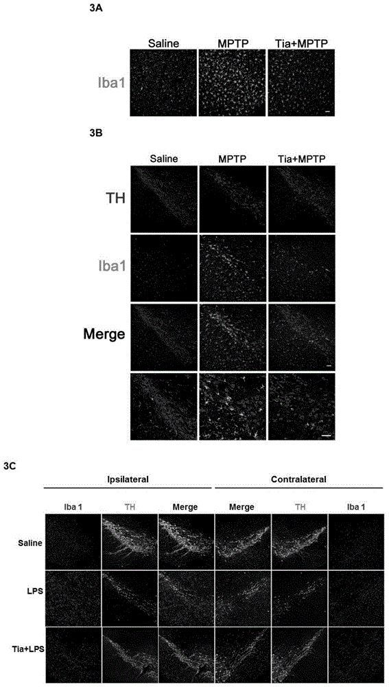 Applications of tiagabine in preparing medicines for treating dopaminergic neuron injuries