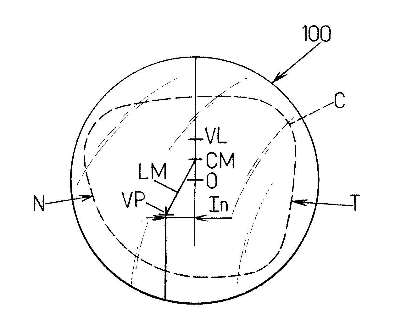 Method for Determining the Inset of a Progressive Addition Lens