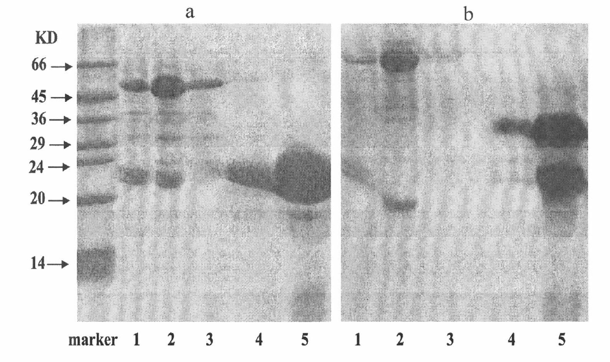 Application of ipomoea batatas Sporamin protein in preparation of medicines for treating and preventing tumours and health products