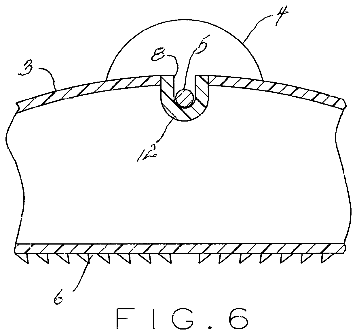 Apparatus for plantar foot pain treatment