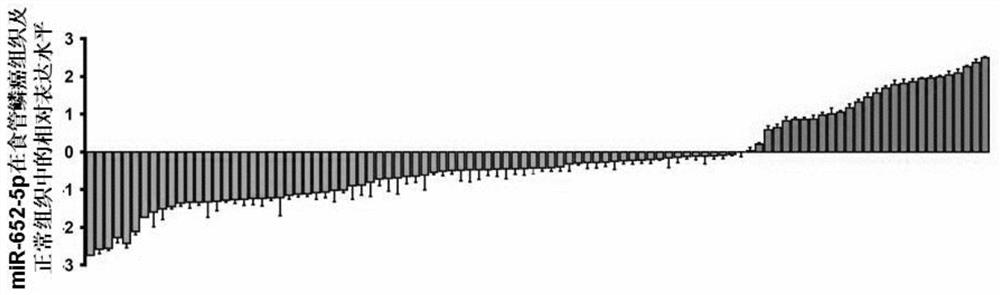 The application of the marker mir-652-5p on the metastasis, prognosis and treatment of esophageal squamous cell carcinoma in drugs and kits