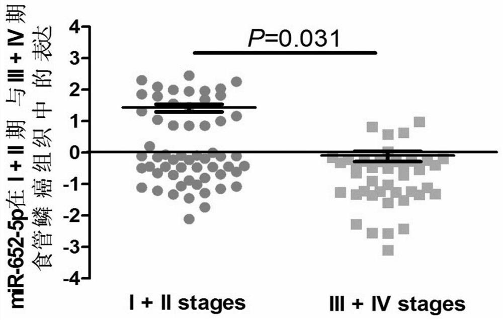 The application of the marker mir-652-5p on the metastasis, prognosis and treatment of esophageal squamous cell carcinoma in drugs and kits