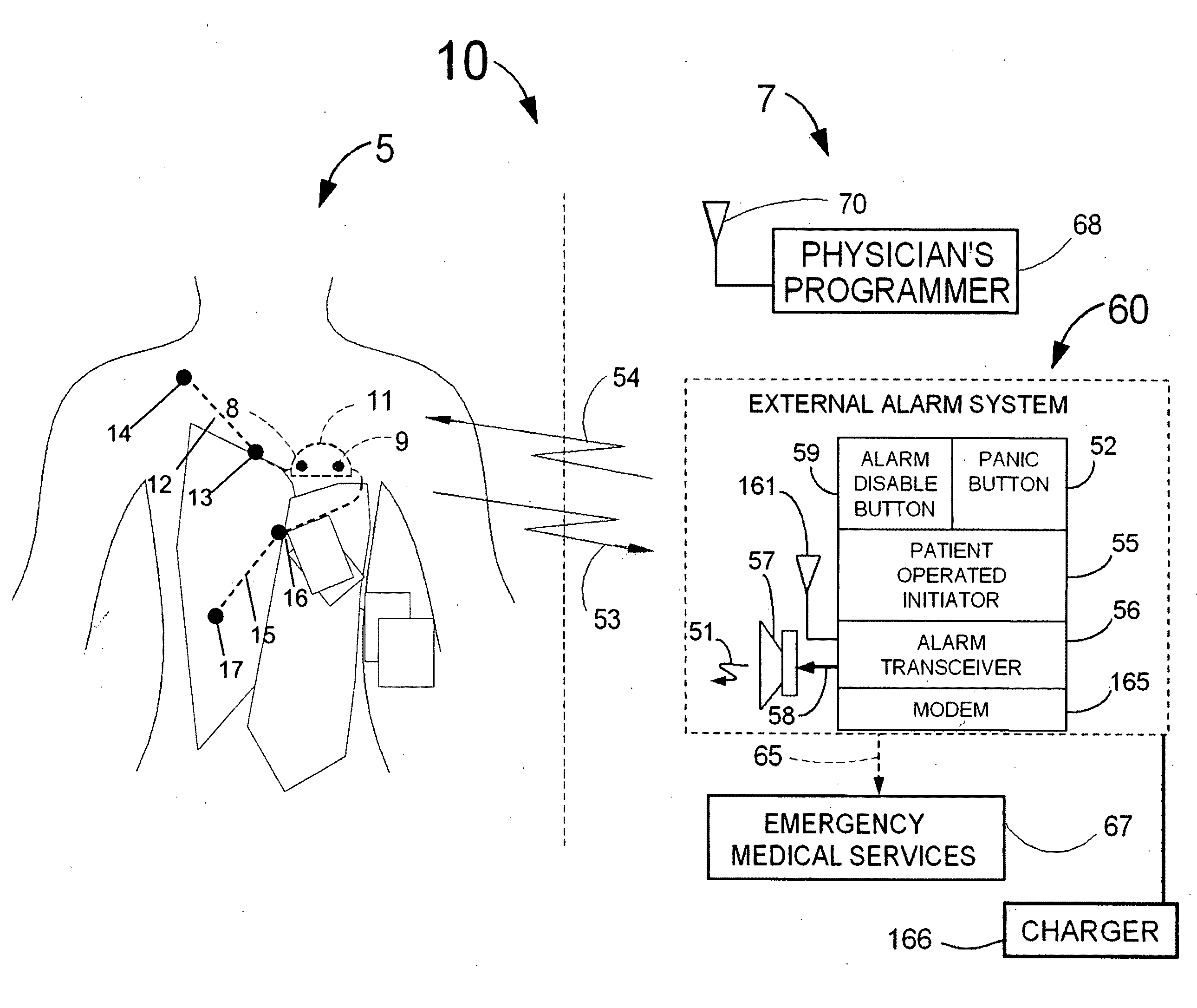 Heart rate correction system and methods for the detection of cardiac events