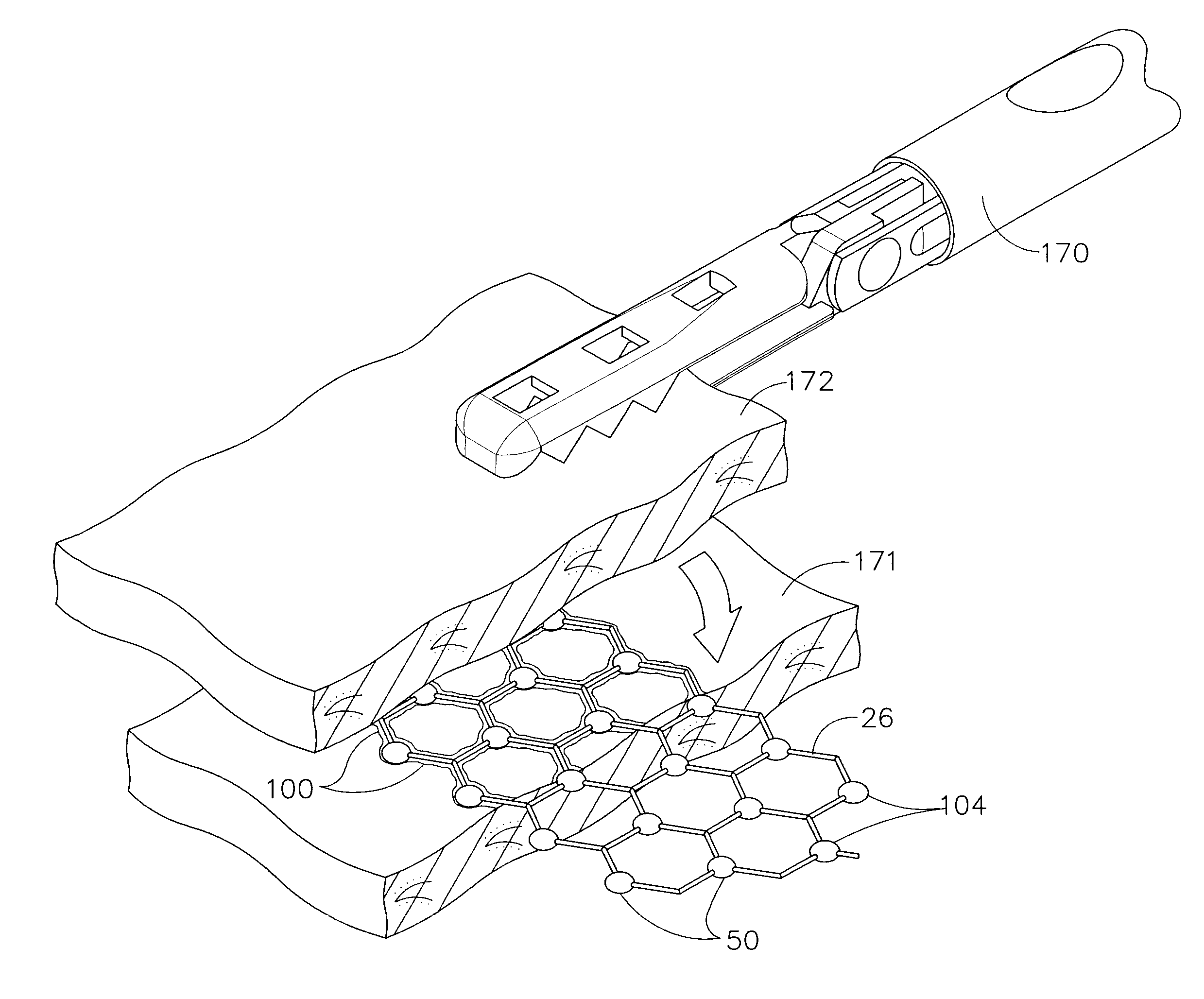 Controlled Adhesive Locations Facilitating Tissue Remodeling