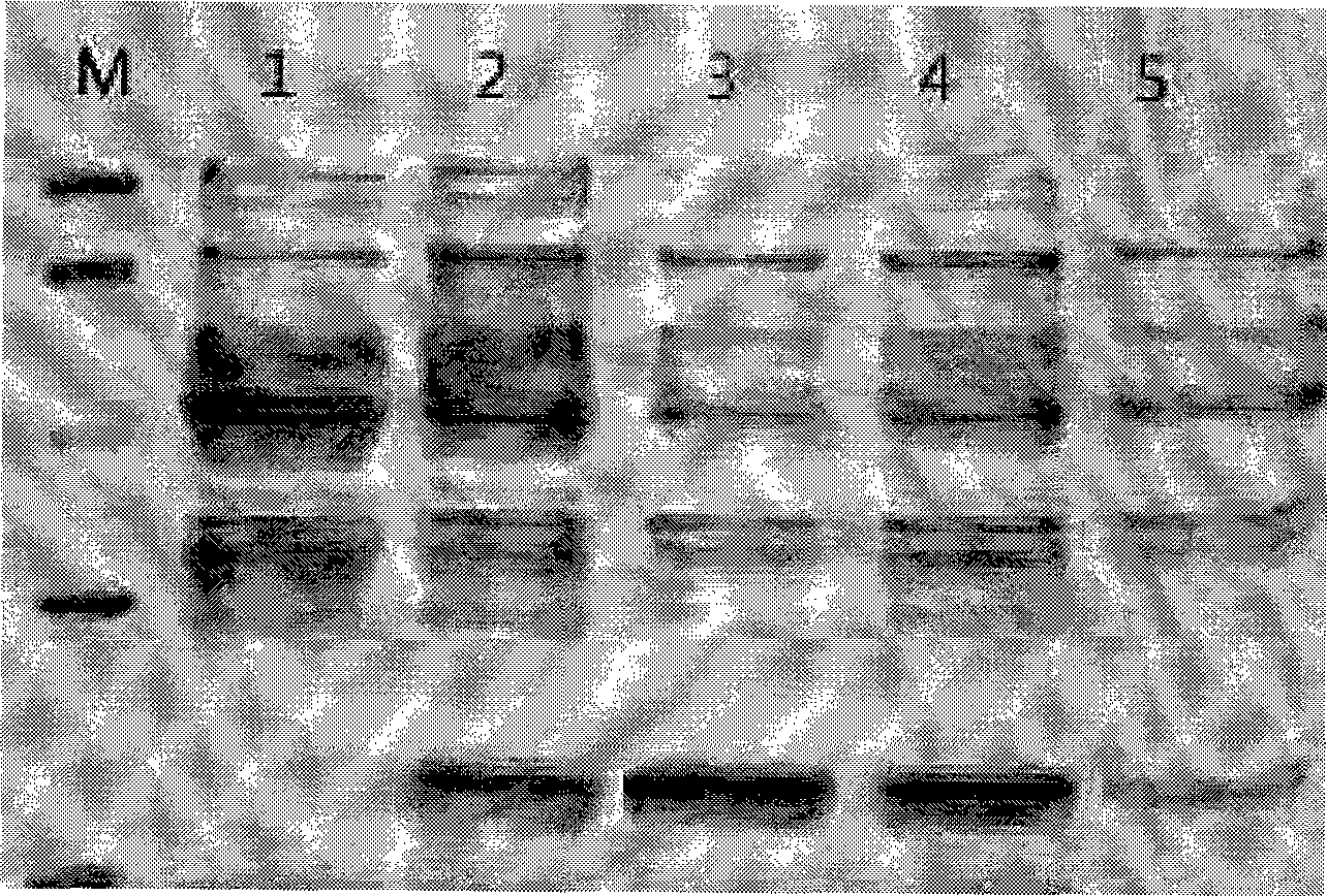 Method for synthesizing protein by using cultivated silkworm middle silk gland vitro expression system