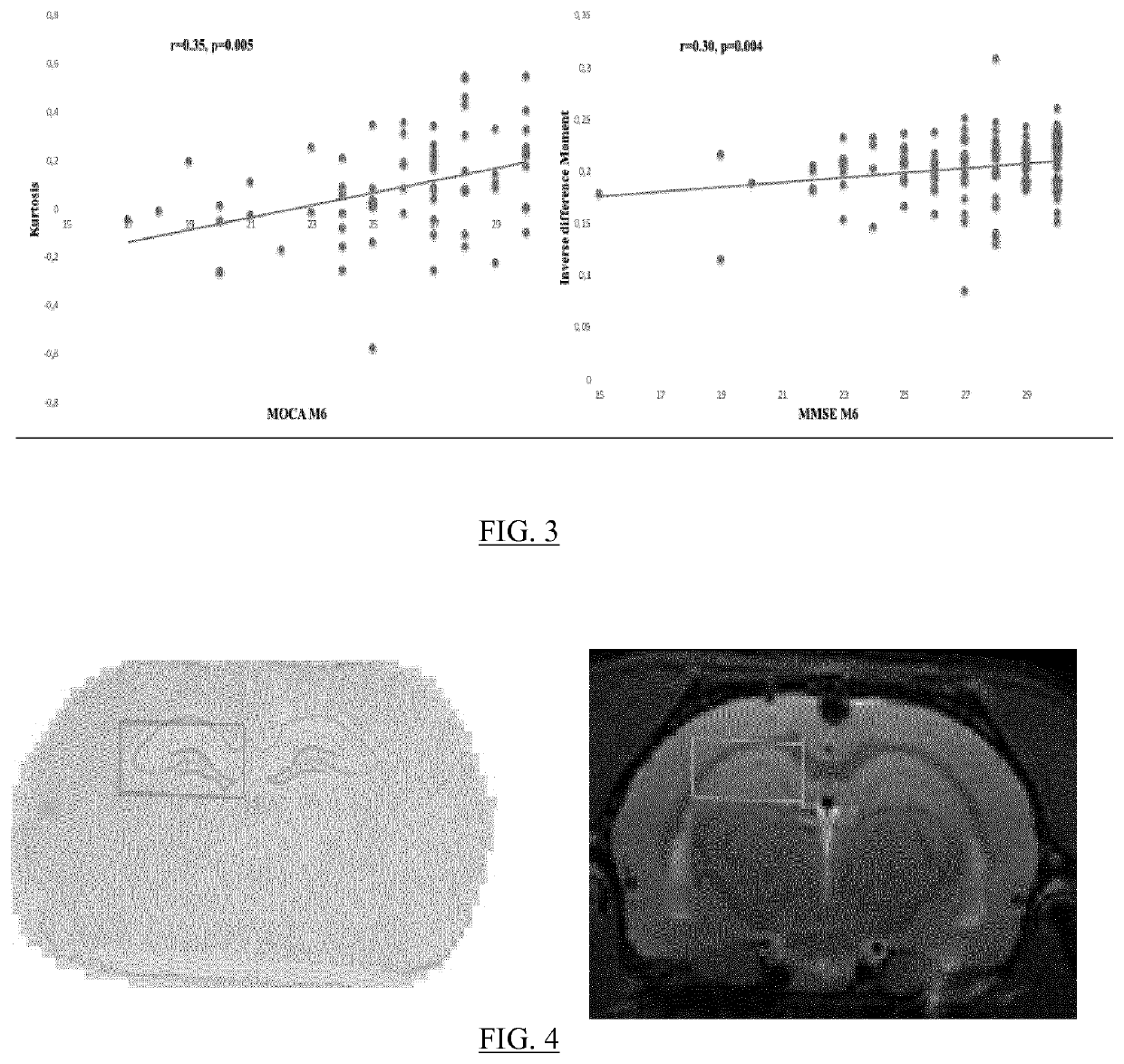 Method for early prediction of neurodegenerative decline